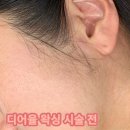 김해 왁싱전문 디어율왁싱 자극없이 깔끔