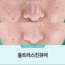 고운피부에스테틱