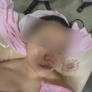 [구로/개봉 피부관리] 이끌림 밸런스케어에서 피부관리 받은 후기!
