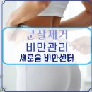 의료법인 일민의료재단 세강병원 | 대구다이어트, 쉽고 빠르게!대구세강병원 세로움비만센터에서 시작하세요