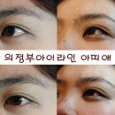 아띠애
