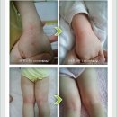 AT알파 2차 후기예요~~ - 울 딸램 엉덩이가 뽀송뽀송~~