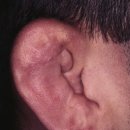 소리귀보청기 이미지