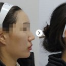 케이톡스의원 인천구월점 네이버블로그