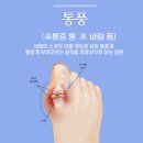 한양류마플러스내과의원 | 수원통풍 발가락 통증이 있다면, 한양류마플러스내과!