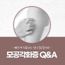 닭살이야 이미지