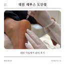 도안동로 11번길 | 대전발관리, 내성발톱, 문제성발톱 각질제거 후기｜레푸스 도안점 솔직후기