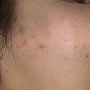 문화원로47번길 | 대전 봉명동 피부관리 르올에스테틱 여드름 관리 후기 찐추천