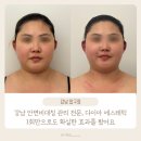 GS25안면백사장점 | 강남 안면비대칭 관리 전문, 다이아에스테틱 얼굴PT 1회만으로도 확실한 효과본 후기
