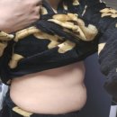 무궁화 다이어트 실제 부작용 후기