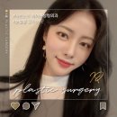 강남성형외과유명한곳 특별한 눈부심