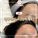 디와이 | 디와이뷰티 청주 페이스 왁싱 후기