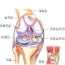 무릎관절증 시큰한 원발성 통증 시작되었다면 대응책 이미지