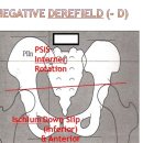 탐슨테크닉 -D(Thompson Technique Negative Derefield) + Sacrum Rotation 이미지