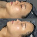 리겐에스테틱 | [전주신시가지피부관리] 실키셀 관리(세멘시트) 리겐 에스테틱 후기