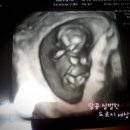 뿅이아니고뿅 이미지