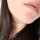 영인 | 방화동에스테틱 영인피부 수분 폭탄 케어 후기