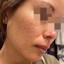 경동약국 | 덱스판테놀 크림 약국 가격 효과 사용 후기 정리했어요