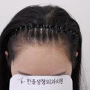 더헤어라인성형외과의원 이미지