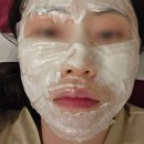 청담스킨성형외과의원 | 청담피부과 추천 청담루틴의원 벨벳주사 통증, 팔뚝지방분해주사 일주일 지난 솔직 후기