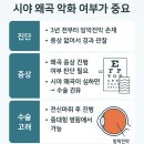 성심안과의원 | 망막전막(황반전막) 3차 진료 후기 – 점점 줄어드는 전막, 수술은 보류