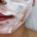 춘천 여드름관리 뷰티애드 | 트러블케어,압출관리 만족 후기