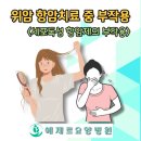 위암 세포독성 항암치료 부작용 알아야, 강남서울성모병원 위암 요양병원 후기좋은 곳을 찾는다면