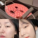 브라이언 pick 커런트바디 LED 마스크 한달 후기 (할인코드)
