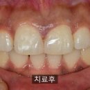 다이아스 이미지