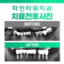 강구치과의원 | 을지로3가역 임플란트 전문 치과 잘하는 곳 후기 좋은곳 추천 6곳