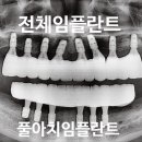 아치치과기공소 이미지