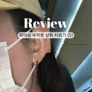 귓바퀴 피어싱 부작용 살튀 제거 수술 후기, 비용, 통증