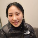 웃을때 잇몸, 거미스마일 보톡스 1분 해결 방법!
