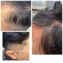 본드헤어(BOND HAIR) | 크리닉염색 블랙본드 시술 후기,흰머리 고민,탱글탱글한 건강모