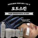 대전여드름관리 잘하는, 오드스킨 솔직후기!