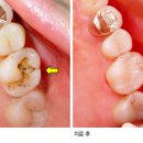 OK치과의원 네이버블로그