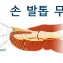 휴먼레이저 이미지