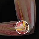 비스타짐 이미지