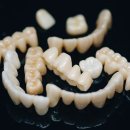 다이아몬드치과기공소 이미지