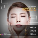 리얼성형외과 이미지