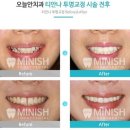 티안나 이미지