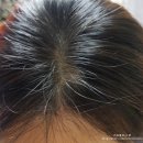 여성원한의원 | 아발론오가닉스샴푸, 원형탈모와서 겟잇뷰티탈모샴푸 구매함!