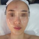 아담과이브 | 용산동피부관리실 아담앤이브 용산점 후기