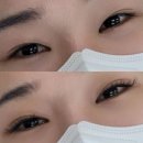 인동속눈썹연장 캣츠아이 마이오드