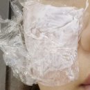 블리비의원 쥬베룩스킨 후기 가격 통증 찐정보