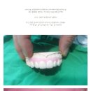JH치과기공소 | 가산동치과 원서울치과 최소삭제라미네이트 리얼스토리 No.4