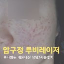 서울더빛의원 | 압구정 루나의원 루비레이저 내돈내산 당일 후기 및 정보 공유
