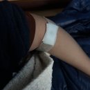 세브란스약국 | 연세세브란스 류마티스내과 외래 5년 차 후기ㅣ강직성척추염 약물치료 과정