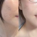 강동구 피부 속부터 차오르는 콜라겐 벨벳 케어 리얼 후기: 쉼,테라피