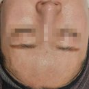 피지메디칼 이미지